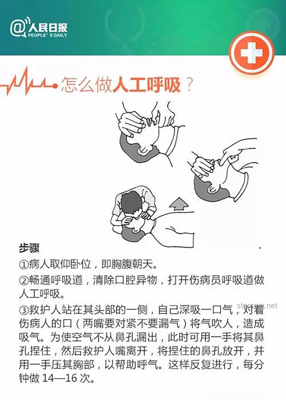 17岁高中生三分钟急救成功案例深度剖析：心肺复苏技能普及的重要性与挑战