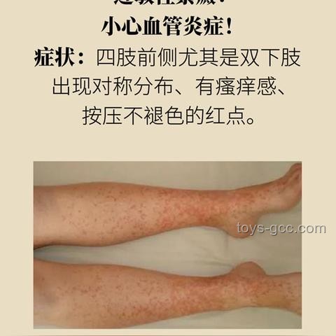 小红点探秘：用AI+医疗新视角，解锁癌变谜团