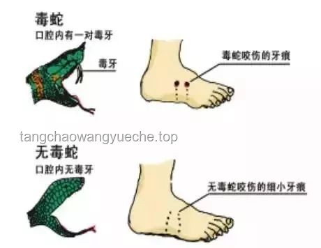 毒蛇咬伤启示录：跨界救援与应急创新